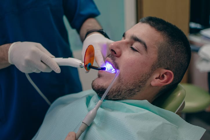 Composite dental bonding provided in Cornwall
